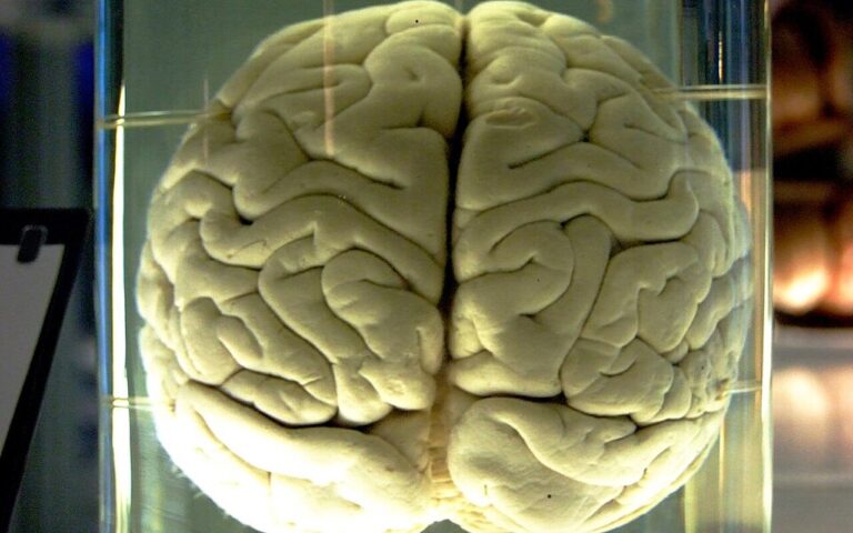 Il cervello può ragionare senza linguaggio, secondo uno studio del MIT