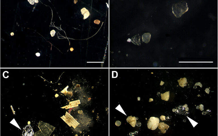 Microplastiche trovate nell’84% dei pazienti colpiti da infarto grave