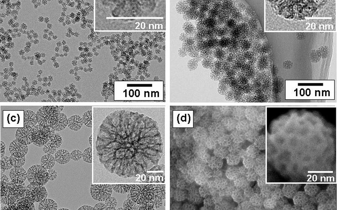 Nanoparticelle magnetiche restituiscono il movimento a topi con sintomi simili al Parkinson